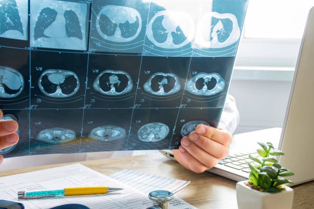 Asbestos Testing London Ensure Your Property is Safe